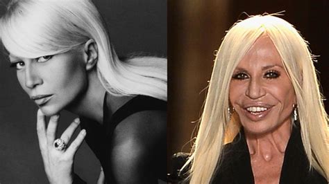 donatella versace without plastic surgery.